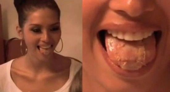 委内瑞拉小姐亚军纳瓦为瘦身 舌头上缝塑胶网