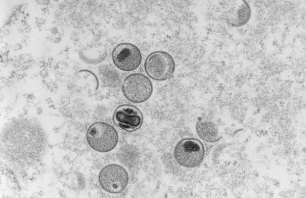 美媒：世界卫生组织计划重新命名猴痘 或为规避“污名化